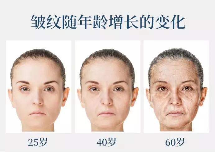 紧急提醒面部肌肤衰老的原因研究出来了清研美素为您解析