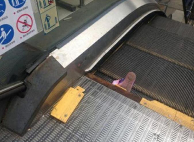 3岁女孩被卡自动扶梯,手臂难保!只因她母亲.