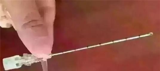 同样是生孩子为何剖腹产低人一等过来人看完几张图片再定论