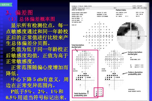 青光眼鼻侧阶梯图片