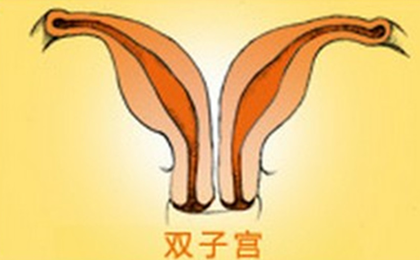 孕妇子宫发育异常,走运生下双胞胎,医生坦言概率只有五千分之一