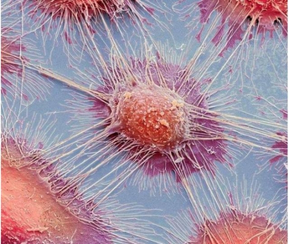 显微镜下的癌细胞竟是这样的11张照片见证神奇世界