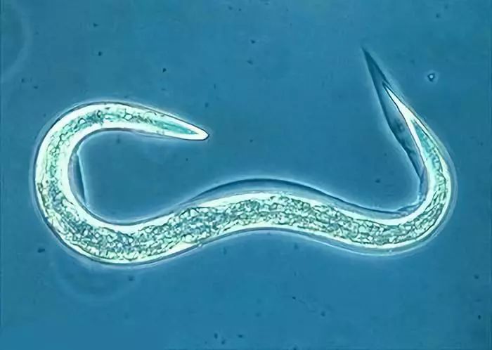 1滴尿即可筛查15种癌症准确率达85以上究竟是什么检查方法