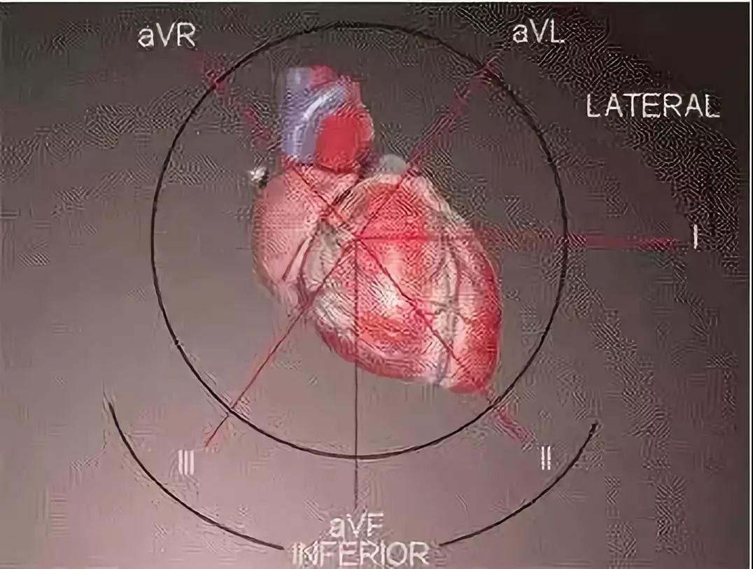【基礎】探清心臟病變的每個細節,請收藏心電圖速成大法