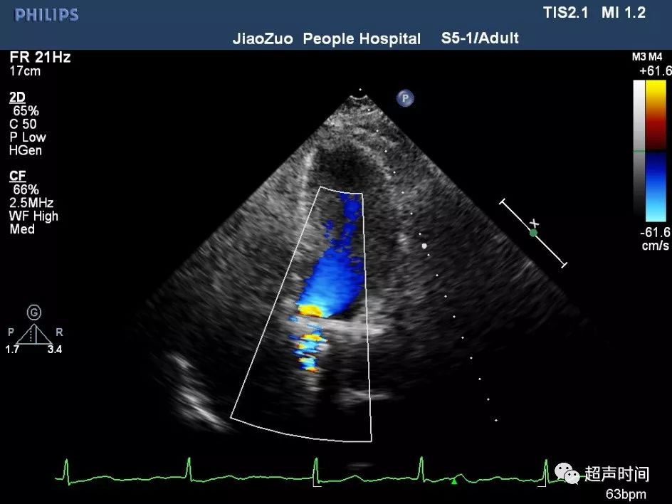 五腔心,(第8页)_大山谷图库