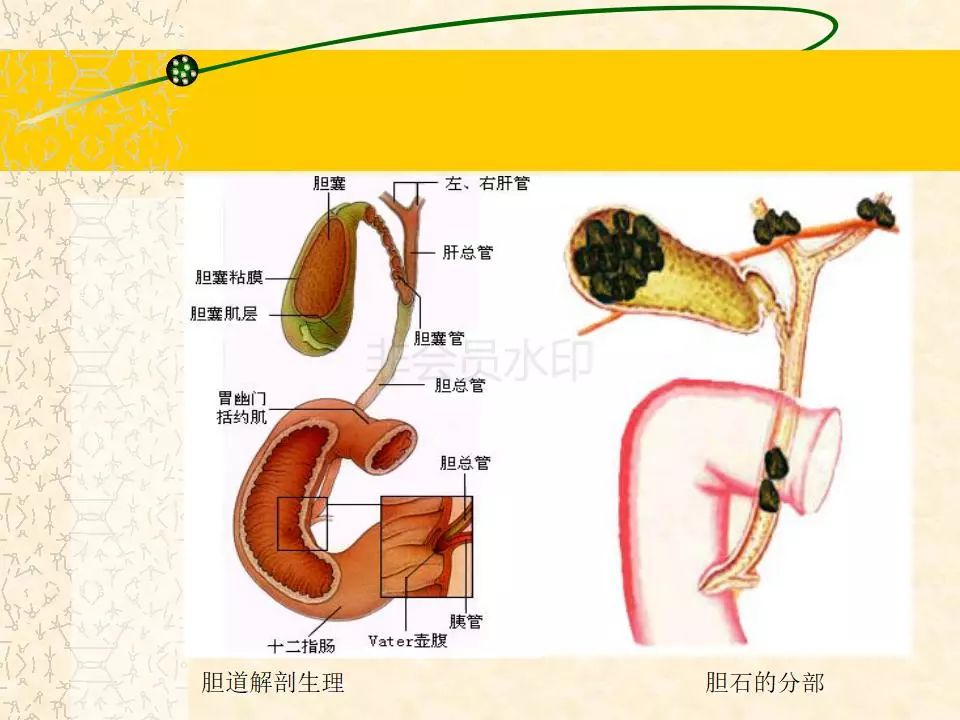 t管引流护理