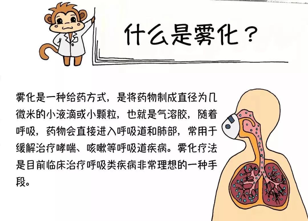 雾化吸入疗法具有操作简单,药物直达病灶,毒副作用小,安全性好等优点