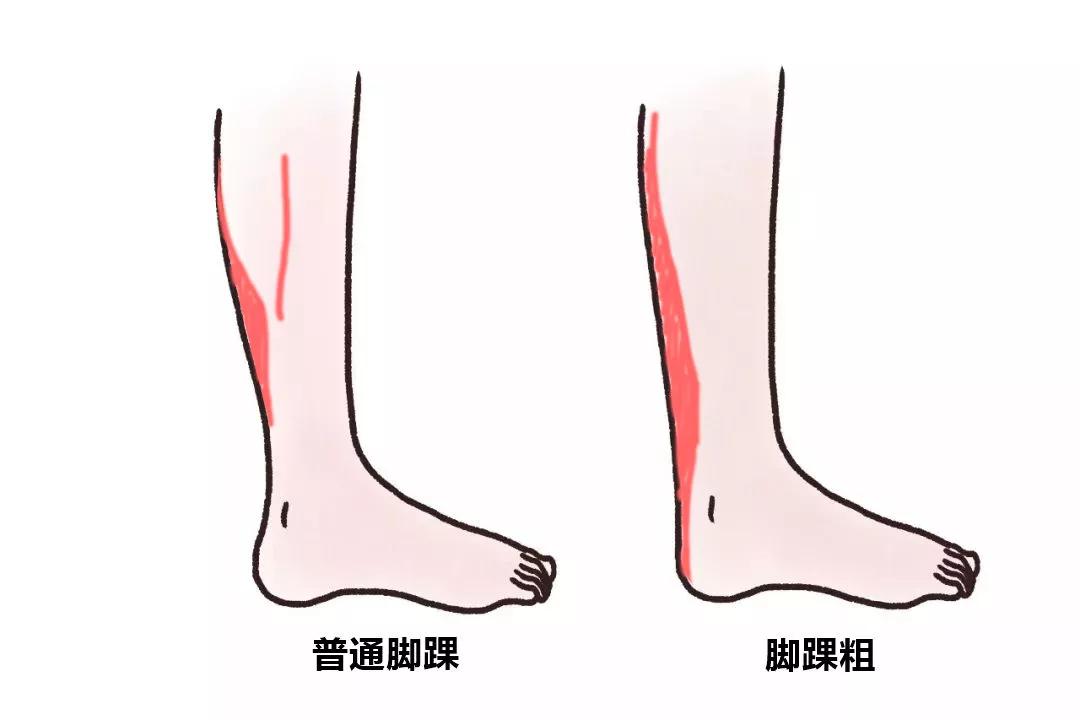 跟腱多长算长图片