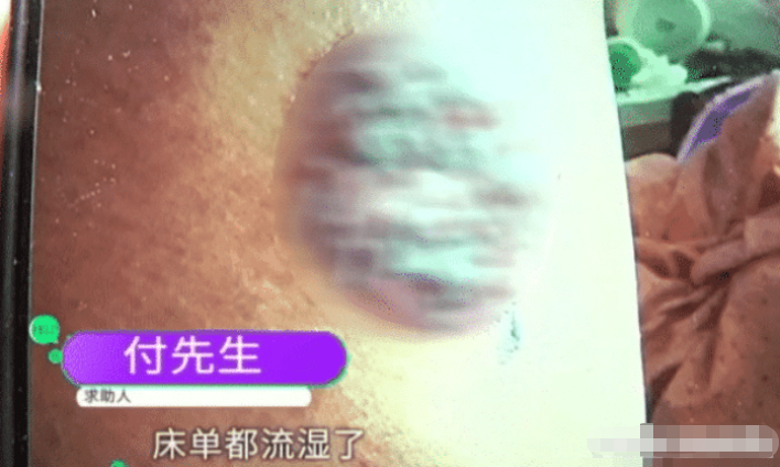 男子去洗浴中心放松,拔火罐时睡着,醒来后尖叫:床单都湿透了!