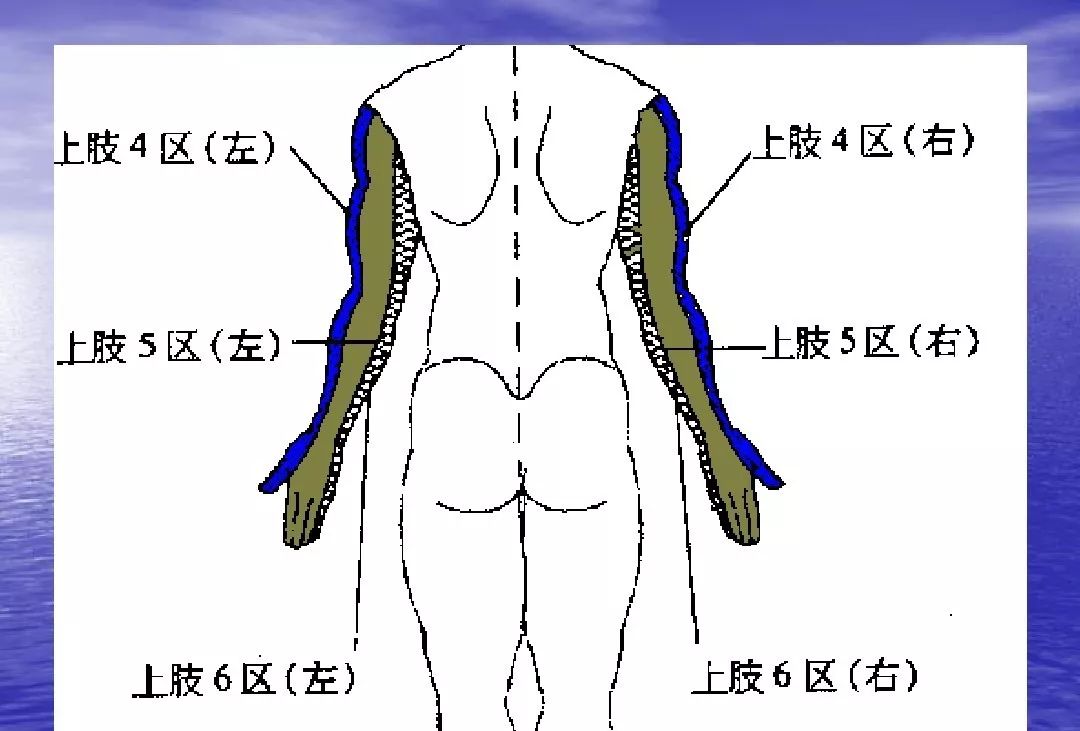 腕踝针分区彩色示意图图片