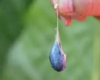 男子生吞蛇胆降火,颅内惊现30公分长活虫