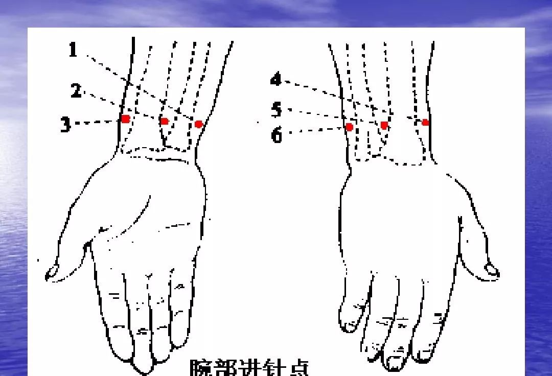 腕踝针快速止痛针法