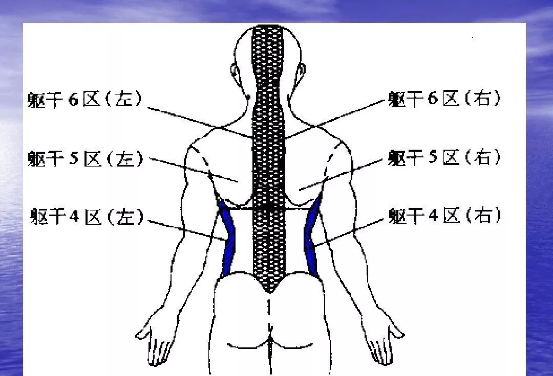 腕踝针分区彩色示意图图片