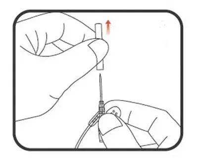 一针见血还扎针不痛第3点最关键
