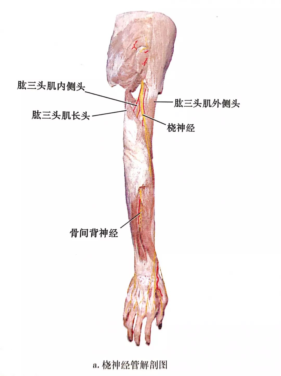 在该处桡神经常常被交叉的腱性肌腱包裹,治疗定点为肱骨外上髁上方10