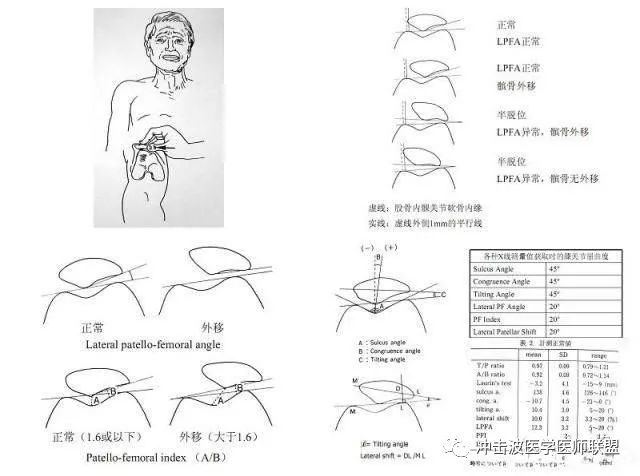 膝关节疼痛的鉴别诊断与内热针疗法治疗