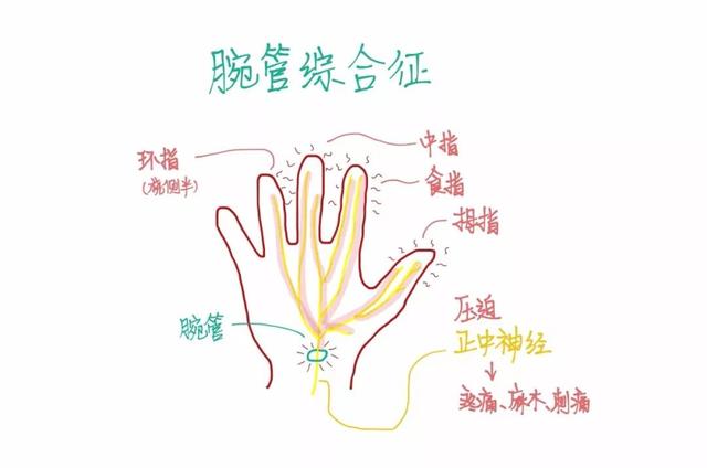 为什么我的手腕痛到不能碰鼠标?_神经