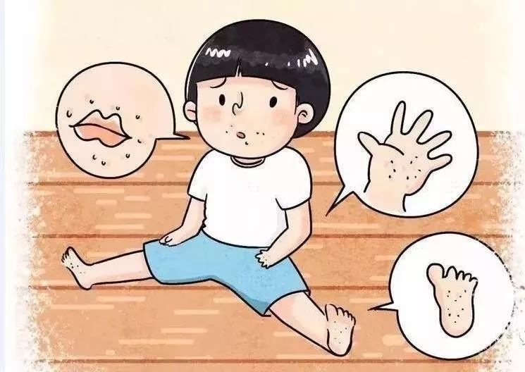 【青生活】手足口病进入高发期,各位家长请注意!_宝宝