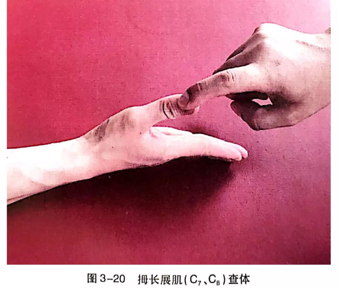 与正中神经支配的拇短展肌作用下的拇指掌外展(拇指