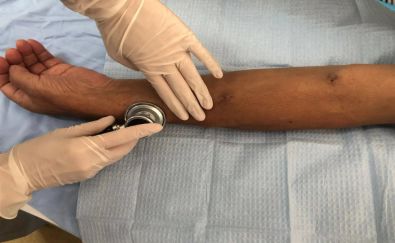 触:用手触摸内瘘口有无震颤听:用听诊器听血流冲击声视:穿刺点及周围