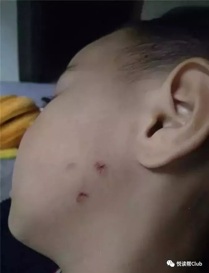 安顺天之骄幼儿园对学生掐脸,打头老师已被刑拘!看视频让父母心痛!