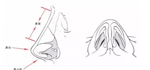 有没有人做了鼻子后悔的?千万不要去隆鼻真后