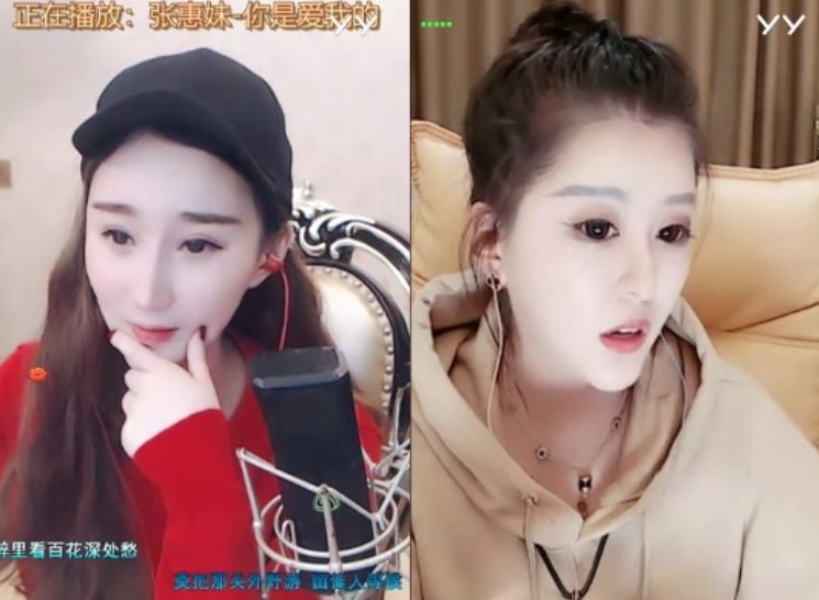 鸽宝自曝整容~除了眼睛全整过,沈曼:我鼻子也动刀了!