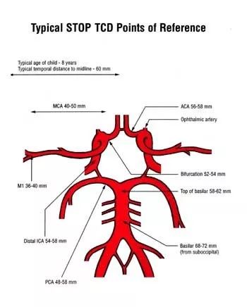 脑底动脉环上各个主要动脉血流动力学参数的一项无创性血管检查方法