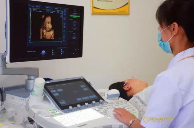 超声诊断仪,四维彩超能够表面成像,更加清晰的筛查胎儿的四肢发育是否