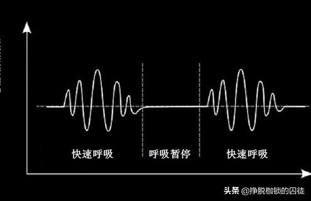 出现潮式呼吸就一定预示着死亡将至?