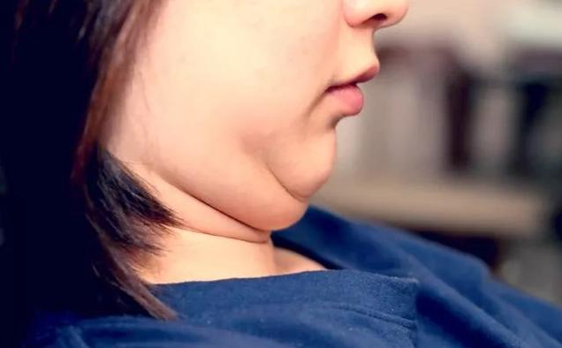 为什么年纪越大脸也越大难道真的只是吃胖了