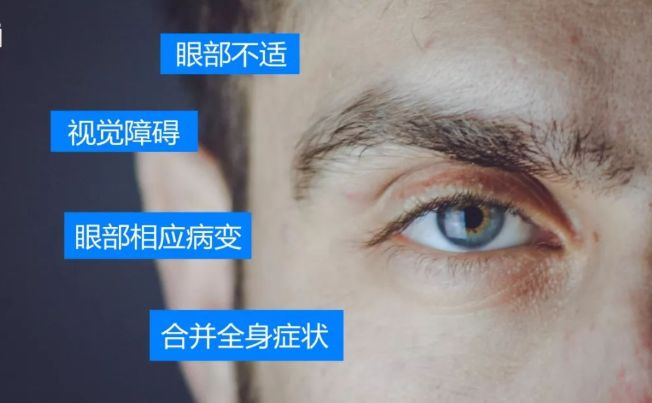 61 视觉障碍:视物不能持久,远近不能调节,视物变形,视物不清或重影