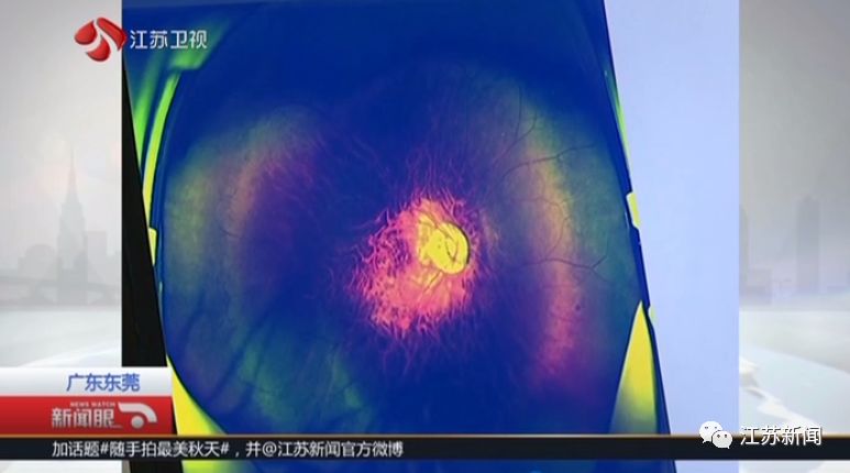 少年近视2400度散光250度这个坏习惯或许你也有