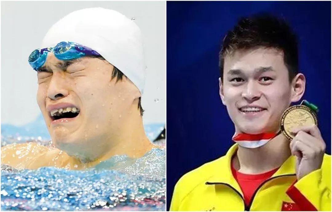 最明显的例子就是孙杨,他在矫正牙齿之前这一口东倒西歪的牙齿实在是