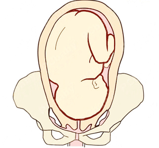 左枕前位胎儿图图片