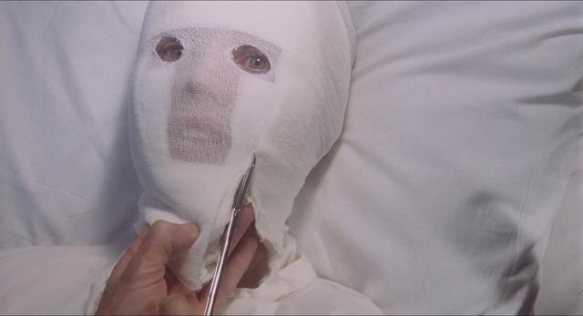 整个脑袋缠着纱布,只露出两只眼睛的费多拉躺在病床上颤抖如木乃伊