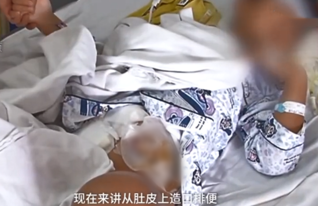 家长无视警告,7岁男童遭喷泉水冲击下体,肠道受损无法正常排便