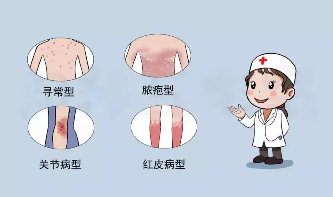 银屑病的临床分型银屑病已被联合国卫生组织列为20世纪人类10大顽症之