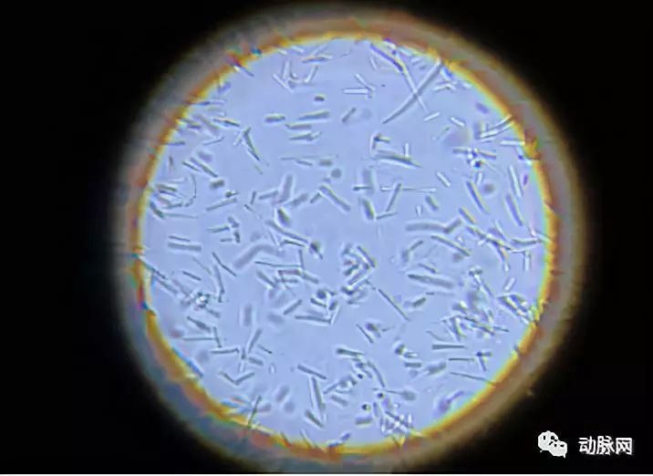 显微镜下的益生菌大小不一,颜色透明,集体行动犹如千军万马向一个方向