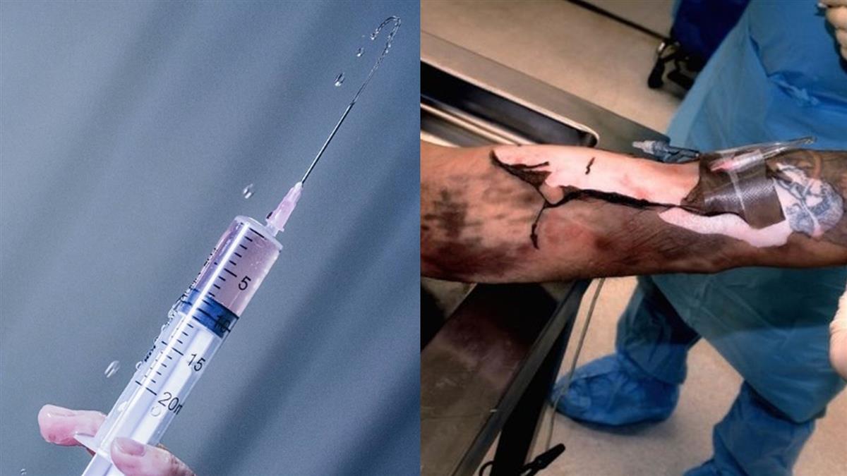 毒针没打好!死囚瞪眼抽蓄 挣扎34分才断气