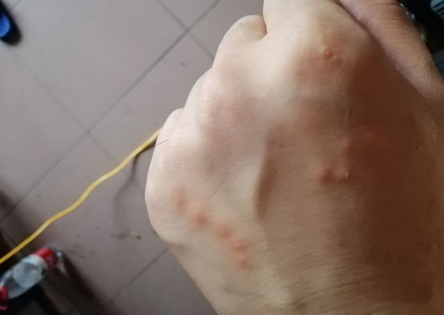 如何判断家里有没有臭虫以及如何杀臭虫