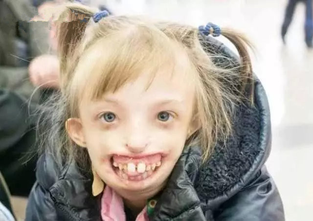 最容易忽视的就是怀孕后的15-56天左右,这期间是导致畸形高度敏感期