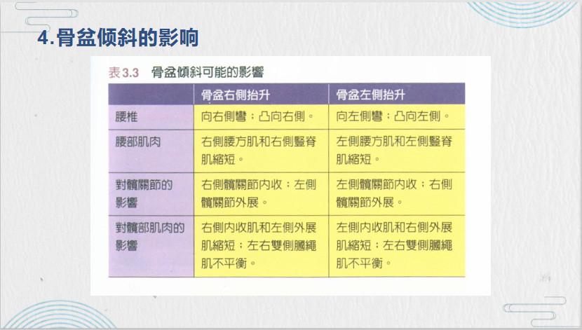 骨盆侧倾自我评估及矫正方法