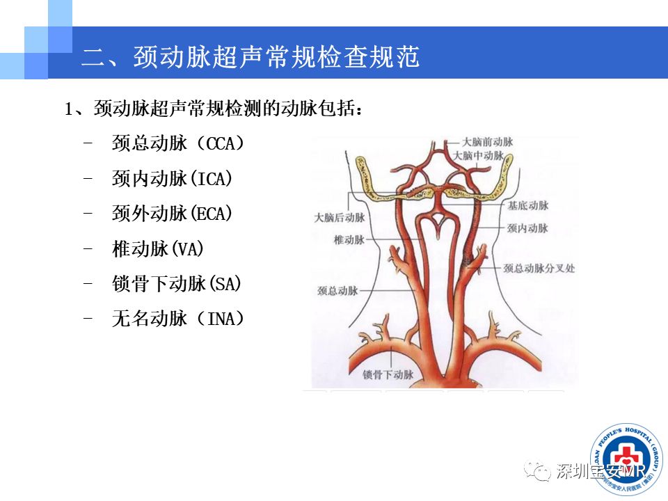 颈总动脉解剖图图片