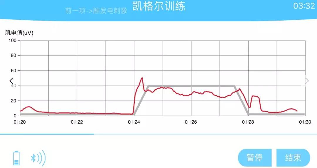 生物反馈采用镇痛方案的电刺激,高频的电刺激(100hz)强直收缩后放松