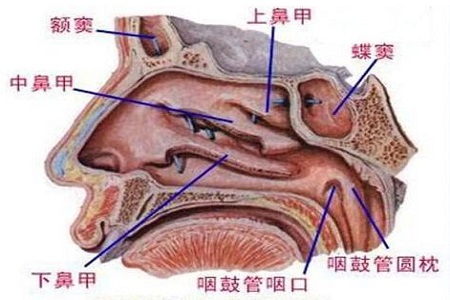 首大崔付军:怎么区分鼻甲增大,鼻甲肿大和鼻甲肥大