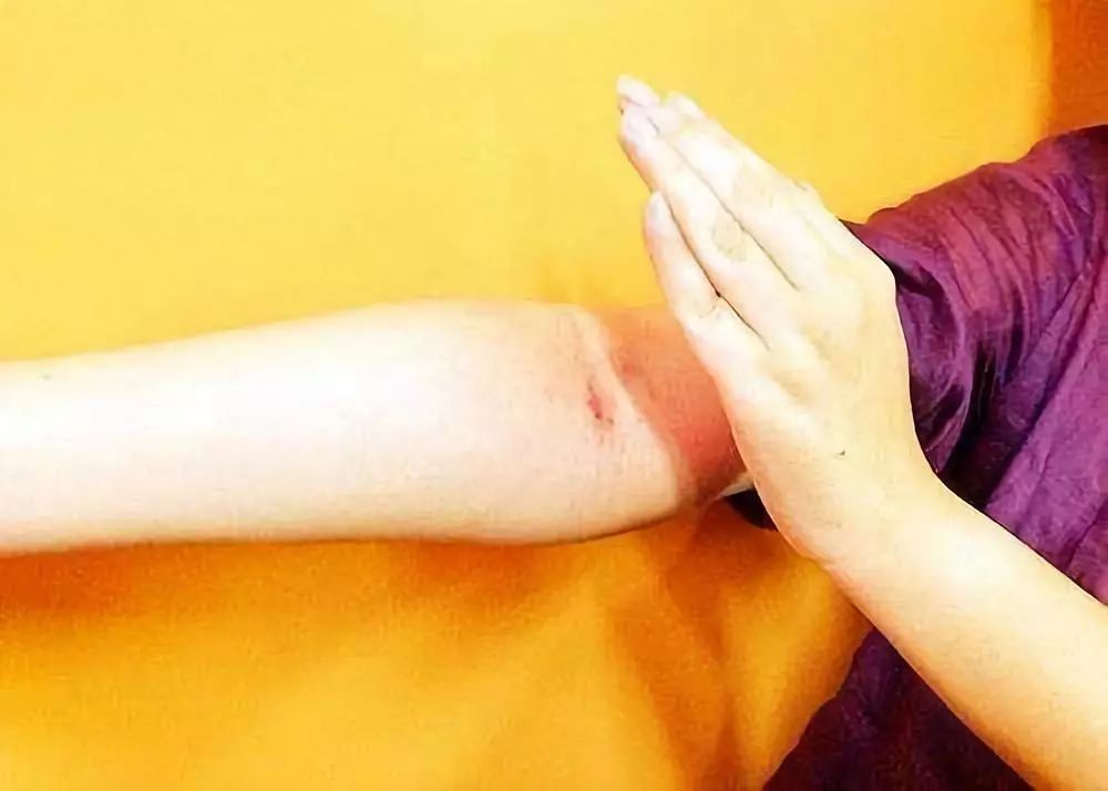 中医养生一起来学经络拍打强身健体远离病痛