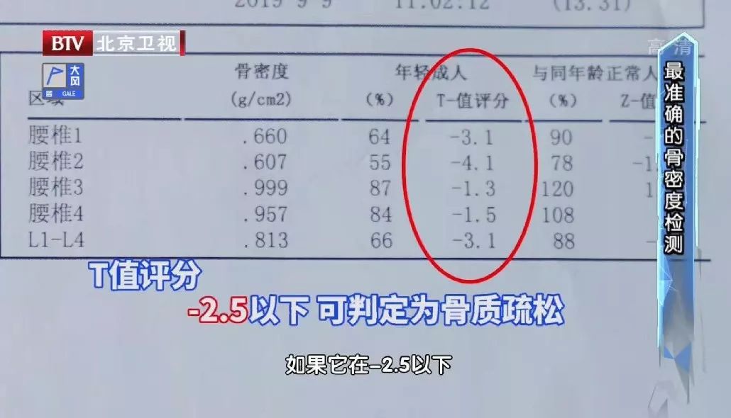 人過40,骨鈣下降易骨折,專家:教你一招自測骨質疏鬆風險,吃對洋蔥留住