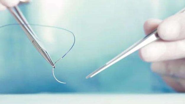 张医师解释为清理狂犬病毒保障患者生命安全伤口在经过三天的处理后才