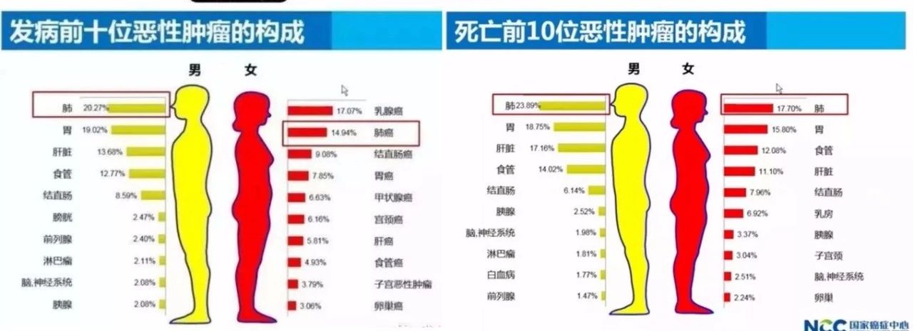 肺癌发病年龄图片